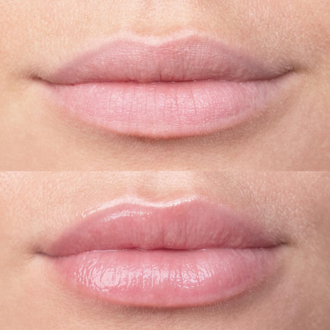 Secret Lips | Lip Boosting Roller