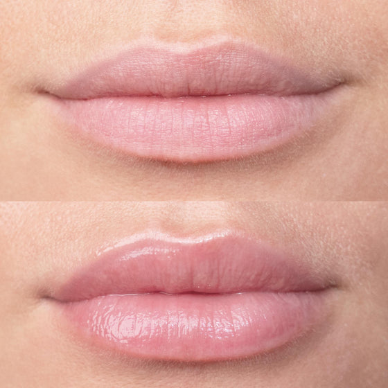 Secret Lips | Lip Boosting Serum
