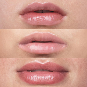 Secret Lips | Lip Boosting Roller – Ansicht 5